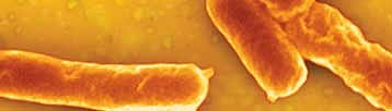 Escherichi coli 0157/H7