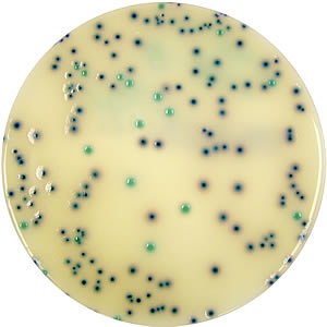 agar solution