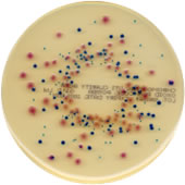 Brilliance UTI Agar; chromogens allow the different organisms that commonly cause UTI infections to be easily differentiated